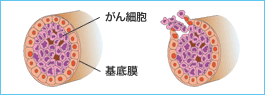 乳房のしくみとがんの種類