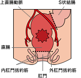 肛門機能温存術