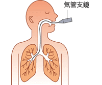 診断を確定するために行われる検査