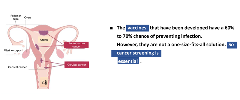 Cervical Cancer