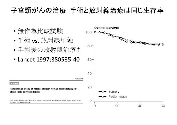 子宮頚がんの治療：手術と放射線治療は同じ生存率