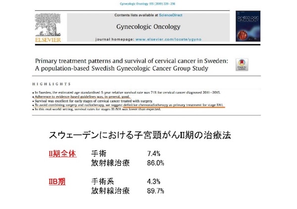 スウェーデンにおける子宮頸がんⅡ期の治療法