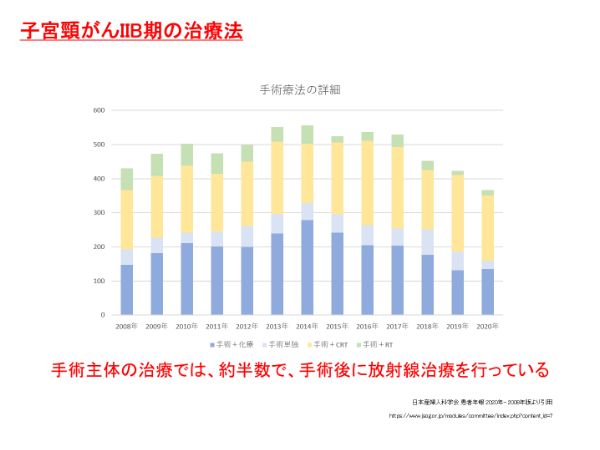 子宮頚がんⅡB期の治療法：手術療法の詳細