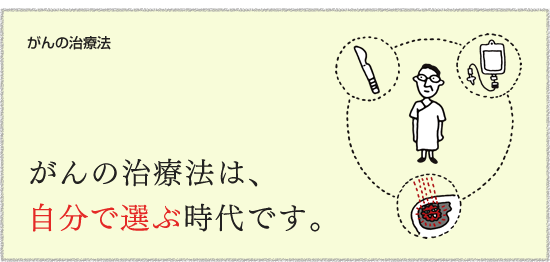 【がんの治療法】　がんの治療法は、自分で選ぶ時代です。